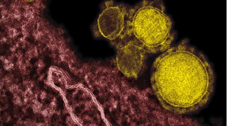 MERS virus kills 19 in week in Saudi Arabia