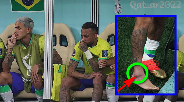 ব্রেকিং নিউজ: নেইমারের বিশ্বকাপ শেষের শঙ্কা