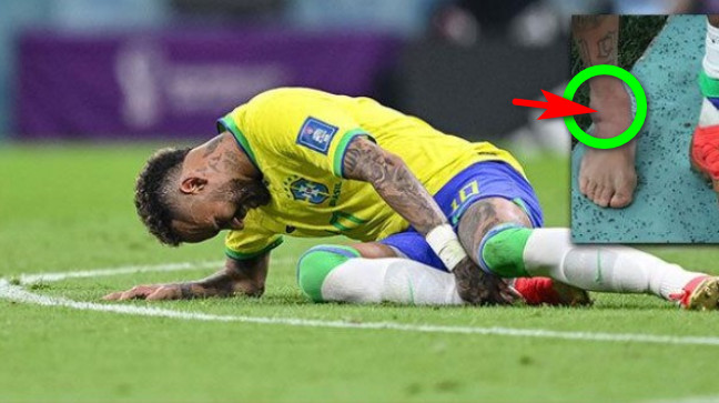 নেইমারের ইনজুরি নিয়ে যা বললেন ব্রাজিল চিকিৎসক