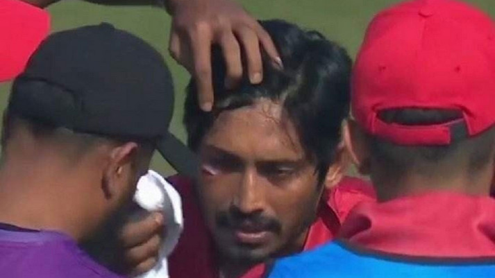 চলতি ম্যাচে বল লেগে আহত এনামুল বিজয় চোখের নিচে ১১ সেলাই