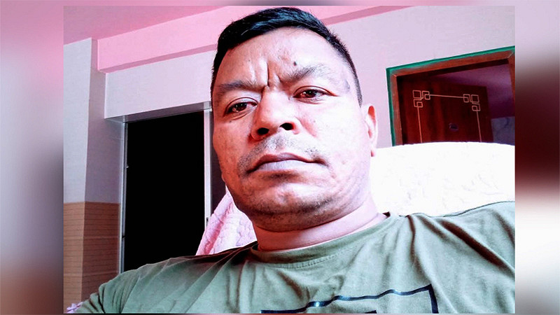 ব্রেকিং নিউজ: আওয়ামী লীগ নেতার রগ কে*টে ফেলে দিয়ে গেল যারা