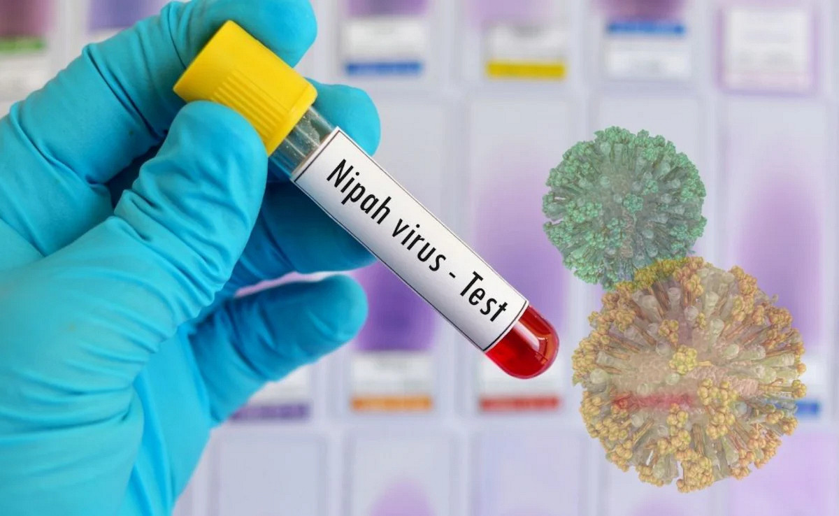 নিপাহ ভাইরাস নিয়ে নতুন সতর্কতা, জেনেনিন লক্ষণ ও প্রতিকার