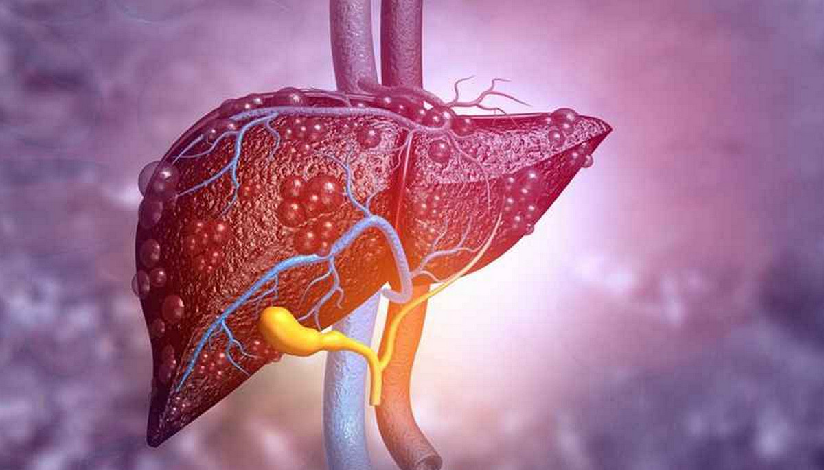 অকালেই বাড়ছে লিভার ক্যানসার! যকৃতের সুরক্ষায় সেরা ৭ খাবার জানুন