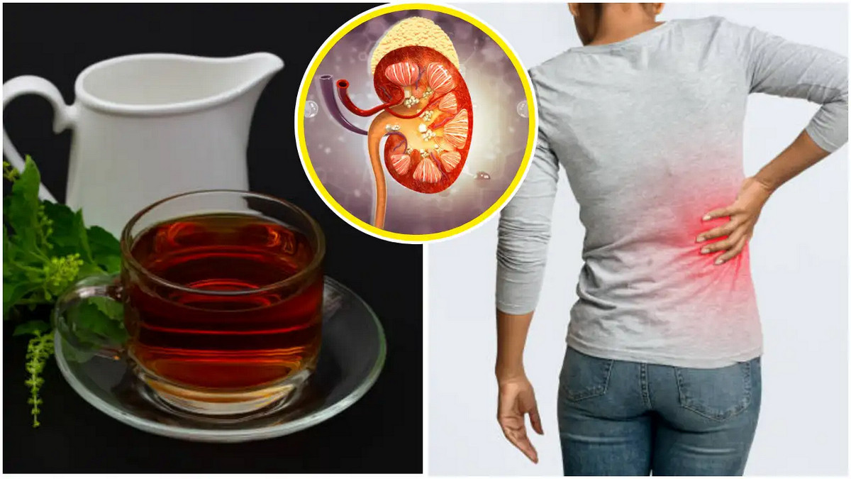 অতিরিক্ত চা পান করলে কিডনিতে পাথর? যা বলছেন বিশেষজ্ঞরা