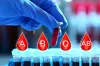 রক্তের গ্রুপ বলে দেবে আপনি কেমন? জেনে নিন আপনার চারিত্রিক বৈশিষ্ট্য