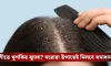 শীতে খুশকির সমস্যা? জেনে নিন ঘরোয়া উপায়ে দ্রুত দূর করার সহজ কৌশল