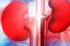 কিডনি বিকল হওয়ার আগে শরীর দেয় ৮ ইঙ্গিত, এখনই সতর্ক হোন