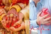উচ্চ রক্তচাপের অন্যতম কারণ বিয়ে! গবেষণা কী বলছে?
